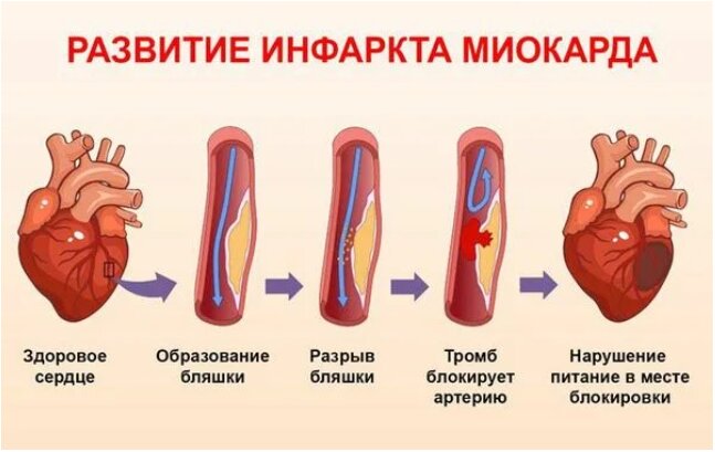 28 09 26 51